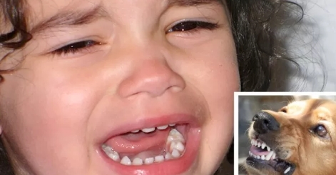 Der Hund greift die dreijährige Tochter an und verletzt sie: Die Mutter gibt dem Mädchen die Schuld